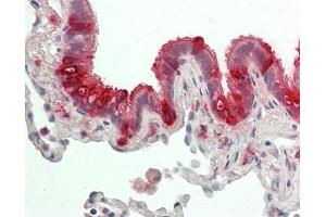 Immunohistochemistry (Paraffin-embedded Sections) (IHC (p)) image for anti-Secretoglobin, Family 1A, Member 1 (Uteroglobin) (SCGB1A1) (AA 23-91) antibody (FITC) (ABIN2627869)