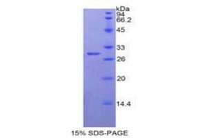 SDS-PAGE analysis of Human Neuronal Pentraxin I Protein. (NPX1 蛋白)