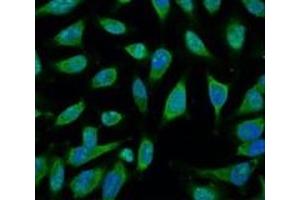 Immunofluorescence analysis of Hela tissue using HSP70 Monoclonal Antibody at dilution of 1:100. (HSP70 抗体)