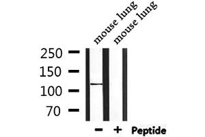 Western blot analysis of extracts from mouse lung, using CEP110 Antibody. (Centriolin 抗体)