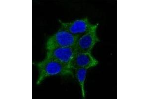 Immunofluorescence testing of LNCaP cells and Alexa Fluor 488 conjugated ODC-1 antibody. (ODC1 抗体)