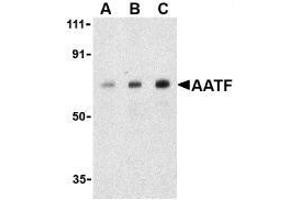 Western Blotting (WB) image for anti-Apoptosis Antagonizing Transcription Factor (AATF) antibody (ABIN499185)