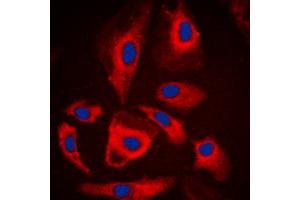 Immunofluorescent analysis of MARK staining in A549 cells. (MARK1 抗体  (Center))