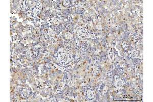 IHC analysis of SPATA18 using anti-SPATA18 antibody (ABIN7601020).