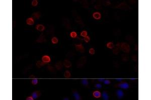 Immunofluorescence analysis of HeLa cells using FLNC Polyclonal Antibody at dilution of 1:100 (40x lens). (FLNC 抗体)