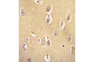 Immunohistochemistry (Paraffin-embedded Sections) (IHC (p)) image for anti-Olfactory Receptor, Family 13, Subfamily J, Member 1 (OR13J1) (AA 244-272), (C-Term) antibody (ABIN953907)