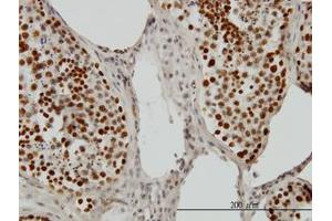 Image no. 1 for anti-PC4 and SFRS1 Interacting Protein 1 (PSIP1) (AA 1-51) antibody (ABIN599171) (PSIP1 抗体  (AA 1-51))