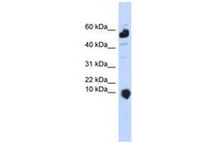 Image no. 1 for anti-Chromosome 1 Open Reading Frame 151 (C1orf151) (C-Term) antibody (ABIN6740907) (C1orf151 抗体  (C-Term))
