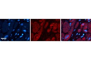 Rabbit Anti-UPF1 Antibody   Formalin Fixed Paraffin Embedded Tissue: Human heart Tissue Observed Staining: Cytoplasmic, nucleus Primary Antibody Concentration: 1:100 Other Working Concentrations: N/A Secondary Antibody: Donkey anti-Rabbit-Cy3 Secondary Antibody Concentration: 1:200 Magnification: 20X Exposure Time: 0. (RENT1/UPF1 抗体  (Middle Region))