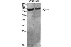 Western Blot (WB) analysis of specific cells using Antibody diluted at 1:1000. (IL4 Receptor 抗体)