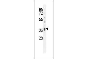 KLHL35 Antibody (C-term) (ABIN656072 and ABIN2845420) western blot analysis in MDA-M cell line lysates (35 μg/lane). (KLHL35 抗体  (C-Term))