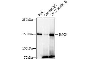 Immunoprecipitation analysis of 300 μg extracts of U-87MG cells using 3 μg SMC3 antibody (ABIN7270616). (SMC3 抗体)