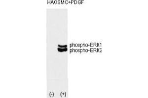 Western Blotting (WB) image for anti-Mitogen-Activated Protein Kinase 1/3 (MAPK1/3) (pThr202), (pTyr204) antibody (ABIN3001885) (ERK1/2 抗体  (pThr202, pTyr204))