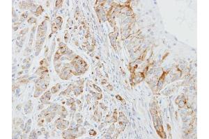 IHC-P Image Immunohistochemical analysis of paraffin-embedded A549 xenograft, using EPB41L3, antibody at 1:100 dilution. (EPB41L3 抗体  (C-Term))