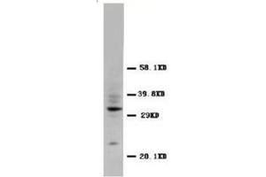 Western blot analysis of rat tissue sections (spleen) using CD40L antibody (CD40 Ligand 抗体  (N-Term))
