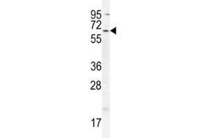 cIAP2 antibody western blot analysis in A549 lysate (BIRC3 抗体  (AA 101-131))