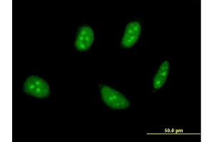 Immunofluorescence of monoclonal antibody to TSC22D4 on HeLa cell. (TSC22D4 抗体  (AA 1-395))