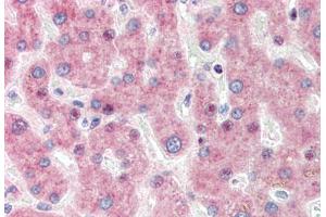 Human Liver (formalin-fixed, paraffin-embedded) stained with IRF3 antibody ABIN337252 at 1:50 followed by biotinylated goat anti-rabbit IgG secondary antibody ABIN481713, alkaline phosphatase-streptavidin and chromogen. (IRF3 抗体)