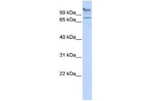 WB Suggested Anti-ZNF509 Antibody Titration:  0. (ZBTB49 抗体  (Middle Region))