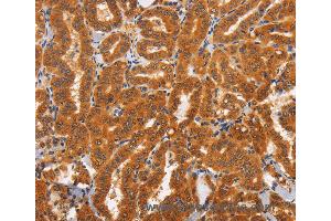 Immunohistochemistry of Human brain  using TNFRSF8 Polyclonal Antibody at dilution of 1:60 (TNFRSF8 抗体)