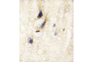 Formalin-fixed and paraffin-embedded human brain tissue reacted with DAAM1 Antibody , which was peroxidase-conjugated to the secondary antibody, followed by DAB staining. (DAAM1 抗体  (C-Term))