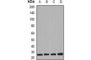 Western blot analysis of PRG2 expression in MCF7 (A), HL60 (B), mouse kidney (C), mouse heart (D) whole cell lysates. (PRG2 抗体)