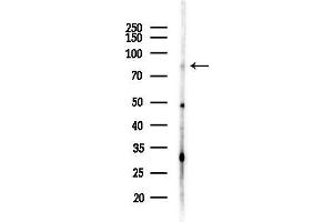 Western blot analysis of lysates from MDA-MB-231 cells(heat-shock,45 min treatment), using PRPF3 Antibody at 1/1000 dilution.