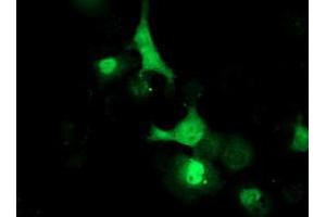 Anti-LCMT1 mouse monoclonal antibody (ABIN2454753) immunofluorescent staining of COS7 cells transiently transfected by pCMV6-ENTRY LCMT1 (RC200018). (LCMT1 抗体)
