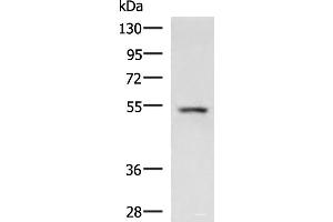 Western blot analysis of Rat liver tissue lysate using ONECUT1 Polyclonal Antibody at dilution of 1:600 (ONECUT1 抗体)
