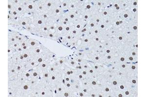 Immunohistochemistry (Paraffin-embedded Sections) (IHC (p)) image for anti-Proliferating Cell Nuclear Antigen (PCNA) (AA 1-261) antibody (ABIN3020826)
