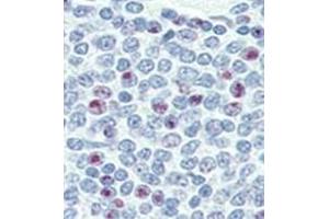Image no. 2 for anti-Nanog Homeobox (NANOG) (AA 25-54), (N-Term) antibody (ABIN357014) (Nanog 抗体  (N-Term))