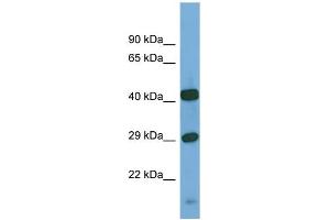 Host:  Rabbit  Target Name:  SGSH  Sample Type:  PANC1 Whole Cell lysates  Antibody Dilution:  1. (SGSH 抗体  (C-Term))