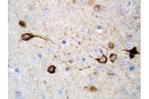 Anti-CAMKK2 antibody, IHC(P) IHC(P): Rat Brain Tissue