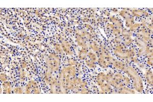 Detection of LEPR in Mouse Kidney Tissue using Polyclonal Antibody to Leptin Receptor (LEPR)