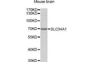 Western blot analysis of extracts of mouse brain, using SLC34A1 antibody. (Solute Carrier Family 34 (Type II Sodium/phosphate Contransporter), Member 1 (SLC34A1) 抗体)