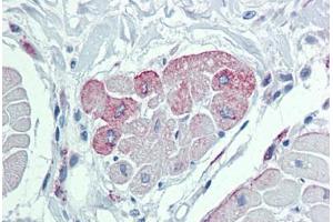 Immunohistochemistry (Formalin-fixed Paraffin-embedded Sections) (IHC (fp)) image for anti-Transient Receptor Potential Cation Channel, Subfamily M, Member 2 (TRPM2) (AA 431-480) antibody (ABIN490062)