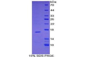 SDS-PAGE analysis of Mouse TNFRSF19L Protein. (TNFRSF19 蛋白)