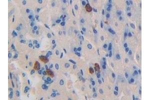 Detection of DNM1 in Mouse Stomach Tissue using Polyclonal Antibody to Dynamin 1 (DNM1) (Dynamin 1 抗体  (AA 572-745))