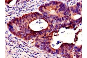 Immunohistochemistry (IHC) image for anti-Nuclear RNA Export Factor 5 (NXF5) (AA 1-200) antibody (ABIN7161940)