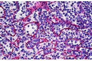 Human Spleen: Formalin-Fixed, Paraffin-Embedded (FFPE) (TIE1 抗体  (Internal Region))