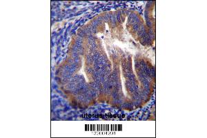 KLC2 Antibody immunohistochemistry analysis in formalin fixed and paraffin embedded human uterus tissue followed by peroxidase conjugation of the secondary antibody and DAB staining. (KLC2 抗体  (N-Term))