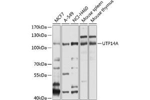 Western blot analysis of extracts of various cell lines, using UTP14A antibody  at 1:1000 dilution. (UTP14A 抗体  (AA 1-260))
