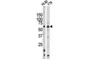 Western Blotting (WB) image for anti-RAD9 Homolog A (S. Pombe) (RAD9A) (pSer328) antibody (ABIN3001777)