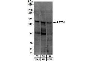 Western Blotting (WB) image for anti-LATS, Large Tumor Suppressor, Homolog 1 (Drosophila) (LATS1) (C-Term) antibody (ABIN7451562)