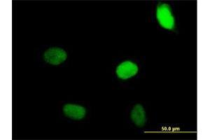 Immunofluorescence of purified MaxPab antibody to ZNF35 on HeLa cell. (ZNF35 抗体  (AA 1-519))