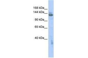 Image no. 1 for anti-Zinc Finger, MYND-Type Containing 8 (ZMYND8) (AA 1115-1164) antibody (ABIN6742534)