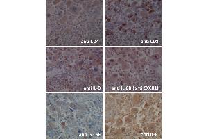Immunohistochemistry (IHC) image for anti-Chemokine (C-X-C Motif) Receptor 1 (CXCR1) (C-Term) antibody (ABIN2854740)