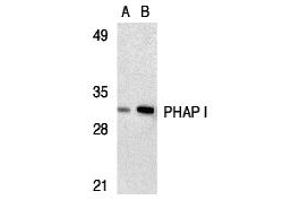 Western Blotting (WB) image for anti-PHAP I (C-Term) antibody (ABIN1030578) (PHAP I 抗体  (C-Term))
