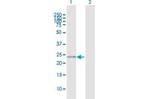 Western Blot analysis of RANBP1 expression in transfected 293T cell line by RANBP1 MaxPab polyclonal antibody. (RANBP1 抗体  (AA 1-201))