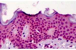 Human Skin: Formalin-Fixed, Paraffin-Embedded (FFPE) (NUP107 抗体  (Internal Region))